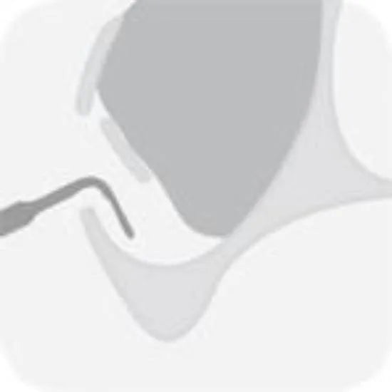 External sinus lift tip 4 - Global Dental Shop